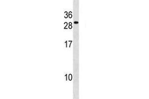 FADD antibody western blot analysis in WiDr lysate (FADD antibody  (AA 106-135))
