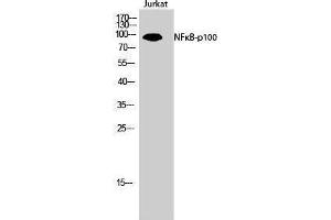 Western Blotting (WB) image for anti-Nuclear Factor of kappa Light Polypeptide Gene Enhancer in B-Cells 2 (NFKB2) (Thr160) antibody (ABIN3176319) (NFKB2 antibody  (Thr160))