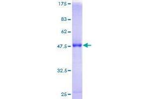 RAB7B Protein (AA 1-199) (GST tag)