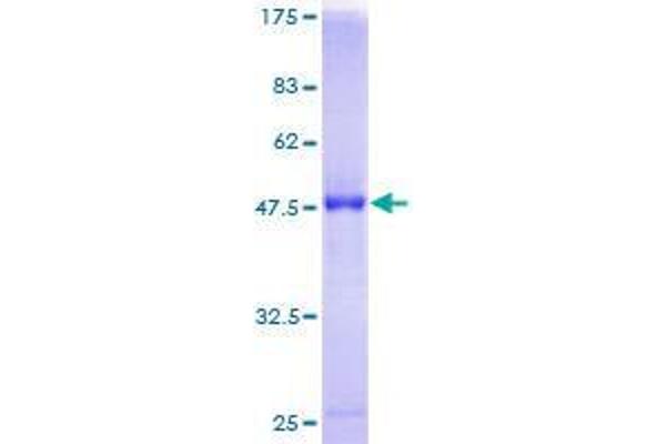RAB7B Protein (AA 1-199) (GST tag)