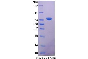 Image no. 1 for Protoporphyrinogen Oxidase (PPOX) (AA 9-300) protein (His tag) (ABIN4990492)