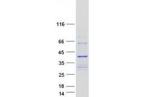 Validation with Western Blot