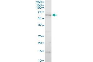 CYP7B1 polyclonal antibody (A01), Lot # 060516JCS1. (CYP7B1 antibody  (AA 203-286))