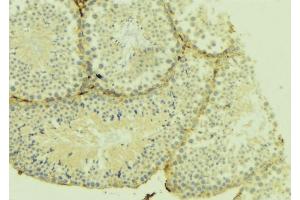 ABIN6274952 at 1/100 staining Mouse testis tissue by IHC-P. (CHST10 antibody  (Internal Region))