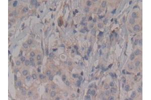 Immunohistochemistry (IHC) image for anti-rho-Associated, Coiled-Coil Containing Protein Kinase 2 (ROCK2) (AA 904-1140) antibody (ABIN7434197)