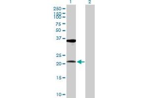Western Blot analysis of RPL10A expression in transfected 293T cell line by RPL10A MaxPab polyclonal antibody.