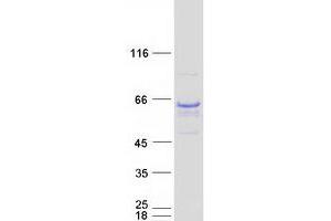 Validation with Western Blot (GIT2 Protein (Transcript Variant 4) (Myc-DYKDDDDK Tag))