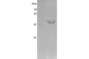 IL-1 beta Protein (AA 115-267) (His tag)