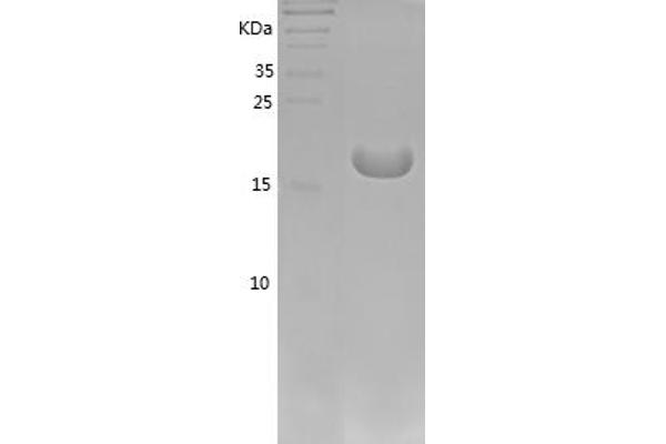 IL-1 beta Protein (AA 115-267) (His tag)