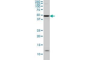 IRX5 monoclonal antibody (M01), clone 6B5 Western Blot analysis of IRX5 expression in HepG2 . (IRX5 antibody  (AA 204-264))