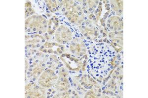 Immunohistochemistry of paraffin-embedded mouse kidney using CGB7 antibody (ABIN5974696) at dilution of 1/100 (40x lens). (CGB7 antibody)