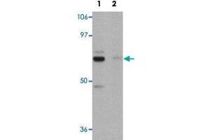 Western blot analysis of rat brain tissue with PIAS4 polyclonal antibody  at 1 ug/mL in (Lane 1) the absence and (Lane 2) the presence of blocking peptide . (PIAS4 antibody  (N-Term))