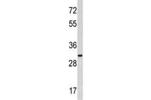 Western blot analysis of MARCKS antibody and HeLa lysate. (MARCKS antibody  (AA 241-271))