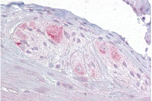 Immunohistochemistry with Small intestine, myenteric plexus tissue at an antibody concentration of 10µg/ml using anti-RBMS3 antibody (ARP40233_P050) (RBMS3 antibody  (Middle Region))