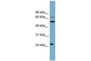 anti-C-Type Lectin Domain Family 6, Member A (CLEC6A) (AA 35-84) antibody