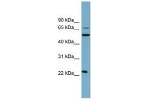 Image no. 1 for anti-C-Type Lectin Domain Family 6, Member A (CLEC6A) (AA 35-84) antibody (ABIN6743312) (C-Type Lectin Domain Family 6, Member A (CLEC6A) (AA 35-84) antibody)