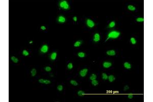 Immunofluorescence of monoclonal antibody to SAE1 on HeLa cell. (SAE1 antibody  (AA 1-346))