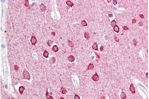 Immunohistochemistry (IHC) image for anti-Protein Kinase C and Casein Kinase Substrate in Neurons 1 (PACSIN1) (N-Term) antibody (ABIN184665)