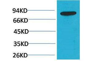 Western Blotting (WB) image for anti-Phosphoinositide 3 Kinase, p85 beta (PI3K p85b) antibody (ABIN3181564)