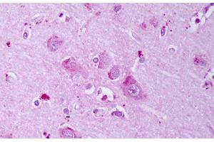 Anti-GABRB1 antibody IHC staining of human brain, cortex neurons. (GABRA1 antibody  (AA 327-450))