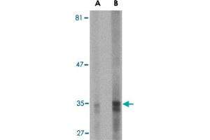 Western blot analysis of ENDOG expression in HepG2 cell lysate with ENDOG monoclonal antibody, clone 7G1G10  at (A) 5 and (B) 10 ug/mL . (Endonuclease G antibody  (AA 76-170))