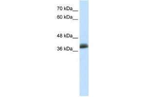 Human MCF-7; WB Suggested Anti-SAP30BP Antibody Titration: 0.