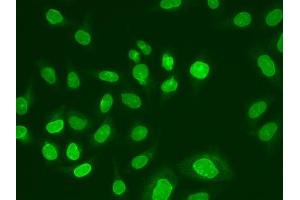 Immunofluorescence analysis of A549 cells using UBE2V1 antibody. (UBE2V1 antibody  (AA 1-147))