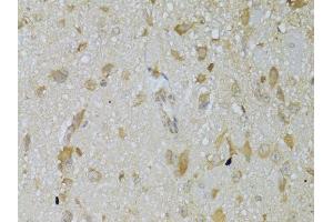 Immunohistochemistry (Paraffin-embedded Sections) (IHC (p)) image for anti-Thyroid Stimulating Hormone Receptor (TSHR) (AA 21-253) antibody (ABIN6149622)