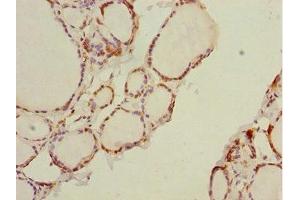 Immunohistochemistry of paraffin-embedded human thyroid tissue using ABIN7164418 at dilution of 1:100 (DTX2 antibody  (AA 1-280))