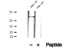 ARHGEF25/GEFT antibody  (Internal Region)