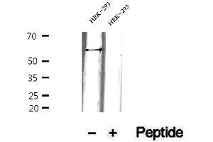 Western blot analysis of extracts of HEK-293 cells, using GEFT antibody. (ARHGEF25/GEFT antibody  (Internal Region))