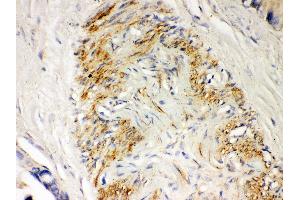 Immunohistochemistry (IHC) image for anti-Parkinson Protein 2, E3 Ubiquitin Protein Ligase (Parkin) (PARK2) (AA 23-416) antibody (ABIN3043896)