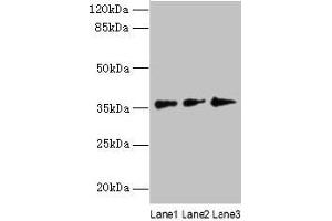 Western blot All lanes: LDAH antibody at 8 μg/mL Lane 1: Hela whole cell lysate Lane 2: Jurkat whole cell lysate Lane 3: A431 whole cell lysate Secondary Goat polyclonal to rabbit IgG at 1/10000 dilution Predicted band size: 38, 33, 23 kDa Observed band size: 38 kDa (LDAH/C2orf43 antibody  (AA 1-325))