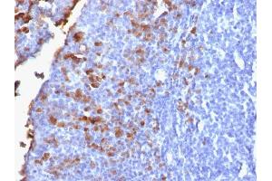 Formalin-fixed, paraffin-embedded human Tonsil stained with IgG Rabbit Recombinant Monoclonal Antibody (IG1707R). (Recombinant IGHG antibody)