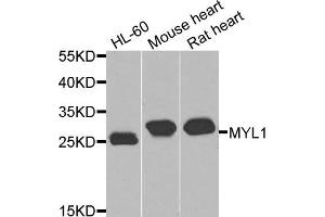 Western blot analysis of extracts of various cells, using MYL1 antibody.
