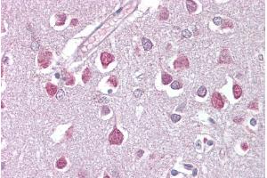 Immunohistochemistry with Brain, cortex tissue at an antibody concentration of 5µg/ml using anti-ETV1 antibody (ARP38528_P050) (ETV1 antibody  (Middle Region))