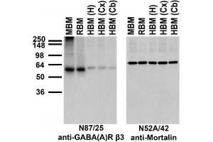 Immunoblot against membrane fractions from whole mouse (MBM) or rat (RBM) brain and from human hippocampus [HBM(H)], cerebral cortex [HBM(Cx)] or cerebellum [HBM(Cb)] and probed with N87/25 (left) or N52A/42 (right) TC supe.