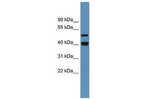 Western Blot showing DDB2 antibody used at a concentration of 1-2 ug/ml to detect its target protein. (DDB2 antibody  (C-Term))
