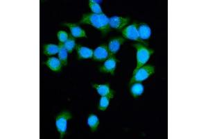 IF analysis of DIAPH1 using anti-DIAPH1 antibody (ABIN7599652). (DIAPH1 antibody  (AA 1039-1153))