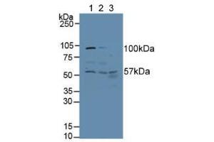 Western blot analysis of (1) Human HeLa cells, (2) Human A431 Cells and (3) Human Liver Tissue.