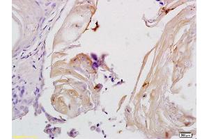 Formalin-fixed and paraffin embedded rat tongue tissue labeled with Anti-Phospho-MYPT1 (Thr853) Polyclonal Antibody, Unconjugated (ABIN744083) at 1:200 followed by conjugation to the secondary antibody and DAB staining (PPP1R12A antibody  (pThr853))