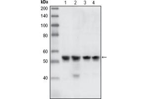 Western blot analysis using CHK1 antibody against HEK293T cells transfected with the pCMV6-ENTRY control (1) and pCMV6-ENTRY CHK1 cDNA (2). (CHEK1 antibody)