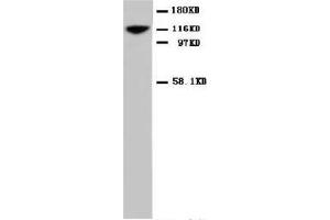 NCAM1 (CD56) Polyclonal Antibody (CD56 antibody  (C-Term))