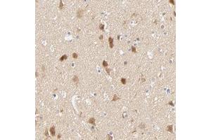 Immunohistochemical staining of human cerebral cortex with SULT4A1 polyclonal antibody  shows moderate cytoplasmic positivity in neuronal cells. (SULT4A1 antibody)