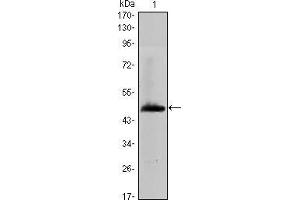 Western blot analysis using HAS1 mAb against human HAS1 (AA: 74-243) recombinant protein. (HAS1 antibody)
