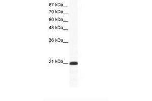 RAX2 antibody  (N-Term)