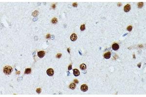 Immunohistochemistry of paraffin-embedded Rat brain using MEF2C Polyclonal Antibody at dilution of 1:100 (40x lens). (MEF2C antibody)