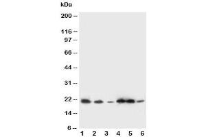 Western blot testing of SSR3 antibody and Lane 1:  rat liver (SSR3 antibody  (AA 8-23))