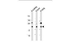 All lanes : Anti-BCL2L10 Antibody (Center) at 1:2000 dilution Lane 1: Human kidney lysate Lane 2: Human liver lysate Lane 3: Human lung lysate Lysates/proteins at 20 μg per lane. (BCL2L10 antibody  (AA 89-123))