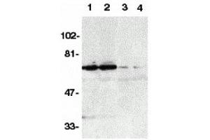 Western Blotting (WB) image for anti-Tumor Necrosis Factor Receptor Superfamily, Member 21 (TNFRSF21) antibody (ABIN1031729) (TNFRSF21 antibody)